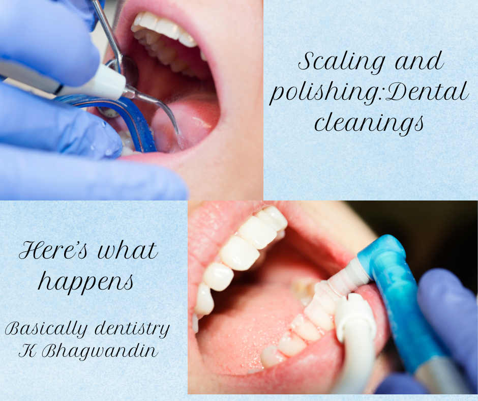 Upper left: close-up of a dental professional using a scaling instrument inside a patient’s mouth. Lower right: close-up of teeth being polished with a rotating dental tool during a cleaning.